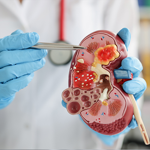 Kidney Specialist in Amritsar